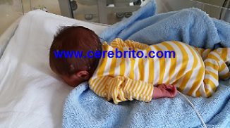 Hipotonia Muscular, bajo tono muscular